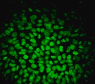 Fluorescent Human ES/iPS Cell Characterization Kit This Fluorescent Human ES/iPS Cell Characterization Kit contains a range of sensitive tools for the phenotypic assessment of the pluripotent status of human Embryonic stem &amp; induced pluripotent Stem cells.