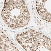 Anti-KIF11 antibody produced in rabbit Prestige Antibodies&#174; Powered by Atlas Antibodies, affinity isolated antibody, buffered aqueous glycerol solution