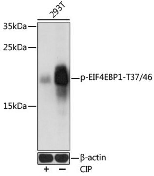 Anti-Phospho-EIF4EBP1-T37/46 antibody produced in rabbit