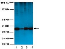 Anti-Actin Antibody, smooth muscle, clone ASM-1 clone ASM-1, Chemicon&#174;, from mouse