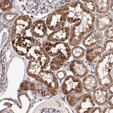Anti-RSC1A1 antibody produced in rabbit Prestige Antibodies&#174; Powered by Atlas Antibodies, affinity isolated antibody, buffered aqueous glycerol solution, ab2