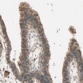 Anti-KEAP1 antibody produced in rabbit Prestige Antibodies&#174; Powered by Atlas Antibodies, affinity isolated antibody, buffered aqueous glycerol solution