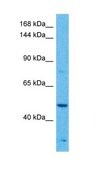 Anti-MAP3K1 antibody produced in rabbit affinity isolated antibody