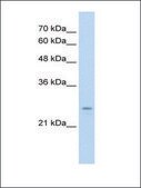 Anti-IER2 antibody produced in rabbit affinity isolated antibody