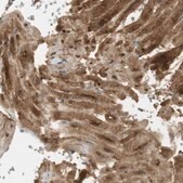 Anti-PDE3A antibody produced in rabbit Prestige Antibodies&#174; Powered by Atlas Antibodies, affinity isolated antibody, buffered aqueous glycerol solution