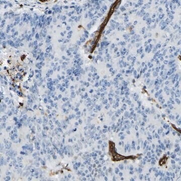 Anti-PLXDC1 antibody produced in rabbit Prestige Antibodies&#174; Powered by Atlas Antibodies, affinity isolated antibody, buffered aqueous glycerol solution