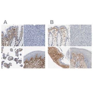 Anti-TGFBI antibody produced in rabbit Prestige Antibodies&#174; Powered by Atlas Antibodies, affinity isolated antibody, buffered aqueous glycerol solution