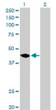 Anti-MAGEA11 antibody produced in rabbit purified immunoglobulin, buffered aqueous solution