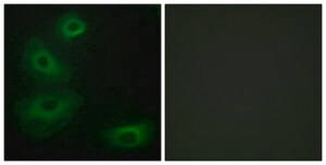 Anti-5-HT-1B antibody produced in rabbit affinity isolated antibody