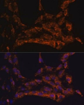 Anti-IL18 antibody produced in rabbit