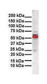 Anti-ESR2 antibody produced in rabbit affinity isolated antibody