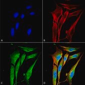 Monoclonal Anti-Mmp9 - Fitc antibody produced in mouse clone S51-82, purified immunoglobulin