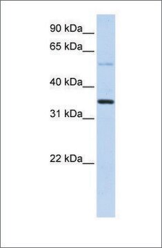 Anti-ANKRD9 antibody produced in rabbit affinity isolated antibody