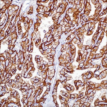 Carbonic Anhydrase IX (CA IX) (MRQ-54) Mouse Monoclonal Antibody