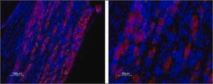 Anti-Calcium Channel CaV3.2 (&#945;1H) antibody produced in rabbit affinity isolated antibody, lyophilized powder