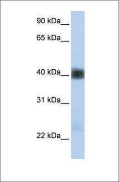 Anti-SGCB antibody produced in rabbit affinity isolated antibody