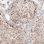 Anti-HGS antibody produced in rabbit Prestige Antibodies&#174; Powered by Atlas Antibodies, affinity isolated antibody, buffered aqueous glycerol solution