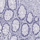 Anti-ABCC2 antibody produced in rabbit Prestige Antibodies&#174; Powered by Atlas Antibodies, affinity isolated antibody, buffered aqueous glycerol solution