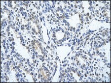 Anti-KRT17 antibody produced in rabbit affinity isolated antibody
