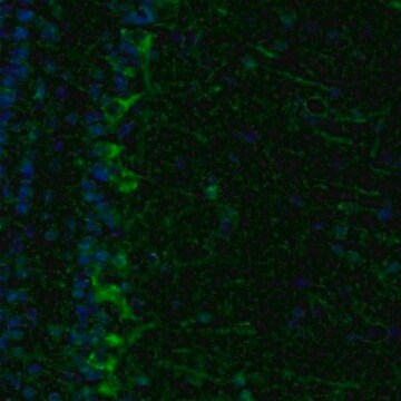 Anti-ECH1 antibody produced in rabbit Prestige Antibodies&#174; Powered by Atlas Antibodies, affinity isolated antibody, buffered aqueous glycerol solution