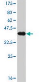 Monoclonal Anti-AFP antibody produced in mouse clone 1G7, purified immunoglobulin, buffered aqueous solution