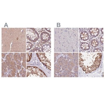 Anti-STIP1 antibody produced in rabbit Prestige Antibodies&#174; Powered by Atlas Antibodies, affinity isolated antibody, buffered aqueous glycerol solution