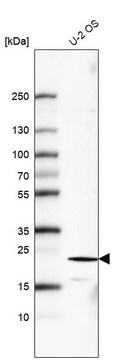 Monoclonal Anti-FGF21 antibody produced in mouse Prestige Antibodies&#174; Powered by Atlas Antibodies, clone CL6491, purified immunoglobulin, buffered aqueous glycerol solution