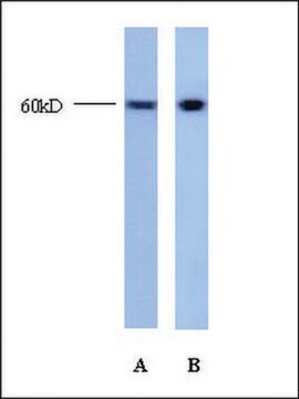 Anti-TRIM22 antibody produced in rabbit affinity isolated antibody