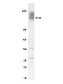 Anti-CFTR Antibody, clone MM13-4 clone MM13-4, Upstate&#174;, from mouse