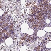 Anti-CDA antibody produced in rabbit Prestige Antibodies&#174; Powered by Atlas Antibodies, affinity isolated antibody, buffered aqueous glycerol solution