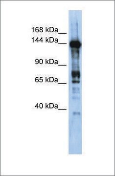 Anti-CASZ1 antibody produced in rabbit affinity isolated antibody