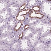 Anti-HTR2B antibody produced in rabbit Prestige Antibodies&#174; Powered by Atlas Antibodies, affinity isolated antibody, buffered aqueous glycerol solution