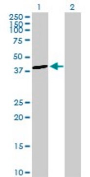 Anti-ALDOB antibody produced in rabbit purified immunoglobulin, buffered aqueous solution