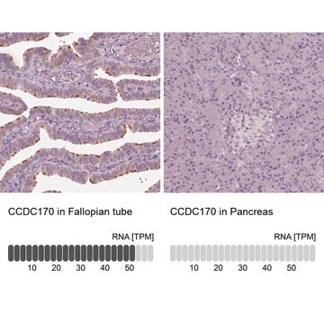 Anti-CCDC170 antibody produced in rabbit Prestige Antibodies&#174; Powered by Atlas Antibodies, affinity isolated antibody, buffered aqueous glycerol solution