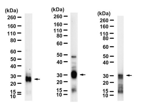 Anti-Trypsin Antibody, clone 1F6 ZooMAb&#174; Rabbit Monoclonal recombinant, expressed in HEK 293 cells