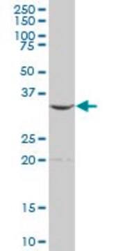 Anti-ALAD antibody produced in mouse purified immunoglobulin, buffered aqueous solution