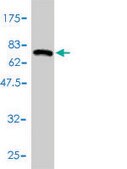 Monoclonal Anti-HDAC11 antibody produced in mouse clone 1C2-2G5, purified immunoglobulin, buffered aqueous solution