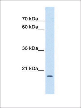 Anti-ASF1B antibody produced in rabbit affinity isolated antibody