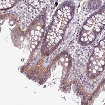 Anti-STK26 antibody produced in rabbit Prestige Antibodies&#174; Powered by Atlas Antibodies, affinity isolated antibody, buffered aqueous glycerol solution