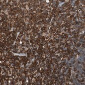Anti-NFATC2 antibody produced in rabbit Prestige Antibodies&#174; Powered by Atlas Antibodies, affinity isolated antibody, buffered aqueous glycerol solution