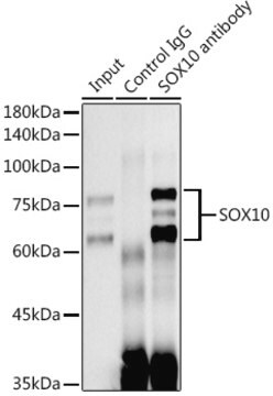 Anti-SOX10 Antibody, clone 3Y3P1, Rabbit Monoclonal