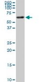 ANTI-AKT2 antibody produced in mouse clone 1D9, purified immunoglobulin, buffered aqueous solution