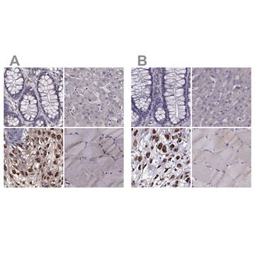 Anti-IKBIP antibody produced in rabbit Prestige Antibodies&#174; Powered by Atlas Antibodies, affinity isolated antibody, buffered aqueous glycerol solution