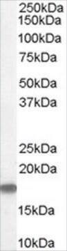 Anti-STMN1/STATHMIN 1 antibody produced in goat affinity isolated antibody, buffered aqueous solution