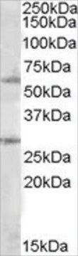 Anti-SOCS7 antibody produced in goat affinity isolated antibody, buffered aqueous solution