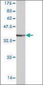 Monoclonal Anti-SYK antibody produced in mouse clone 4A7, ascites fluid