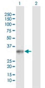 Anti-UCK2 antibody produced in rabbit purified immunoglobulin, buffered aqueous solution