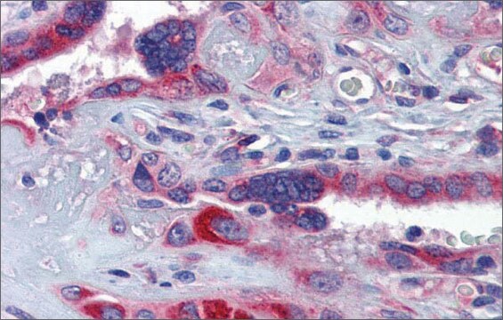 Anti-GTPBP10 (ab1) antibody produced in rabbit affinity isolated antibody