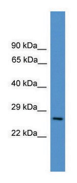 Anti-CD8A antibody produced in rabbit affinity isolated antibody