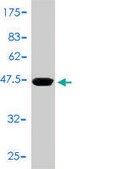 Monoclonal Anti-TNNC1 antibody produced in mouse clone 1F8-A9, purified immunoglobulin, buffered aqueous solution
